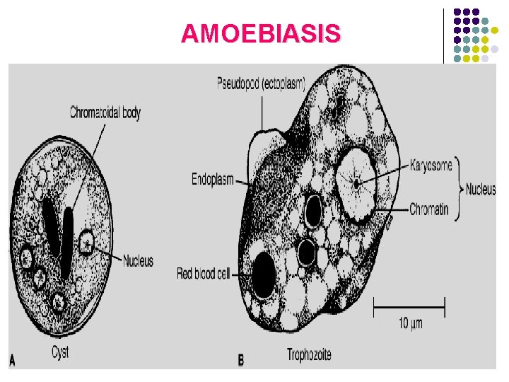 AMOEBIASIS 