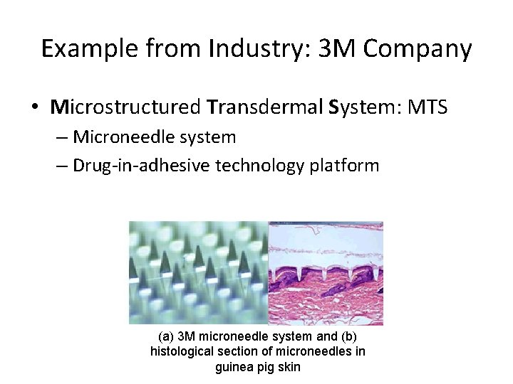 Example from Industry: 3 M Company • Microstructured Transdermal System: MTS – Microneedle system