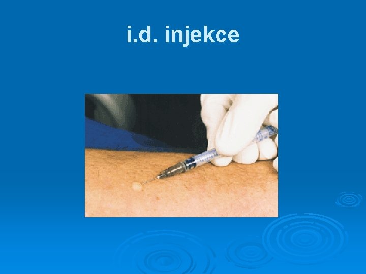 i. d. injekce 