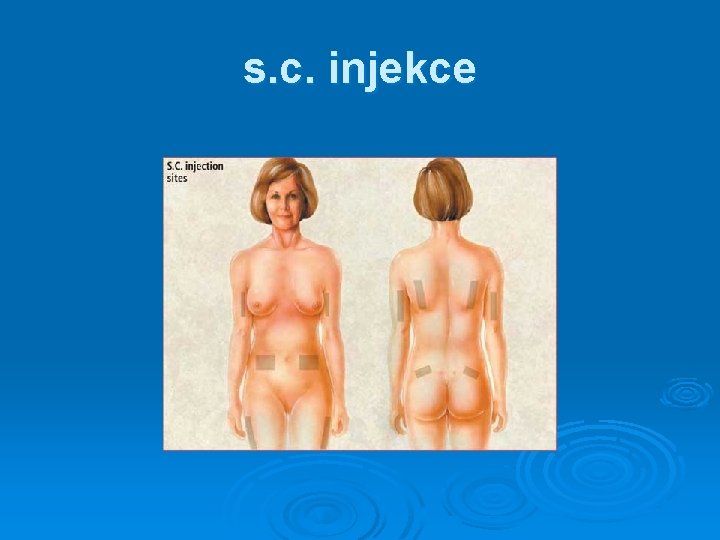 s. c. injekce 