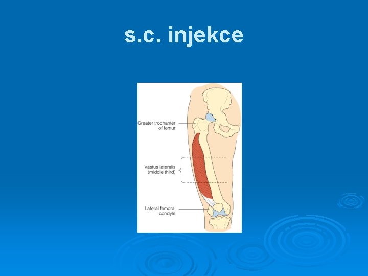 s. c. injekce 