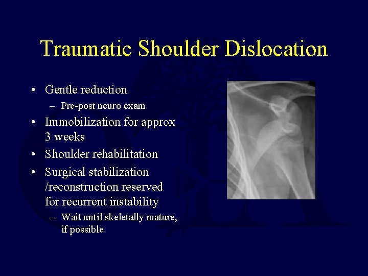 Traumatic Shoulder Dislocation • Gentle reduction – Pre-post neuro exam • Immobilization for approx