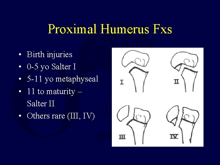 Proximal Humerus Fxs • • Birth injuries 0 -5 yo Salter I 5 -11