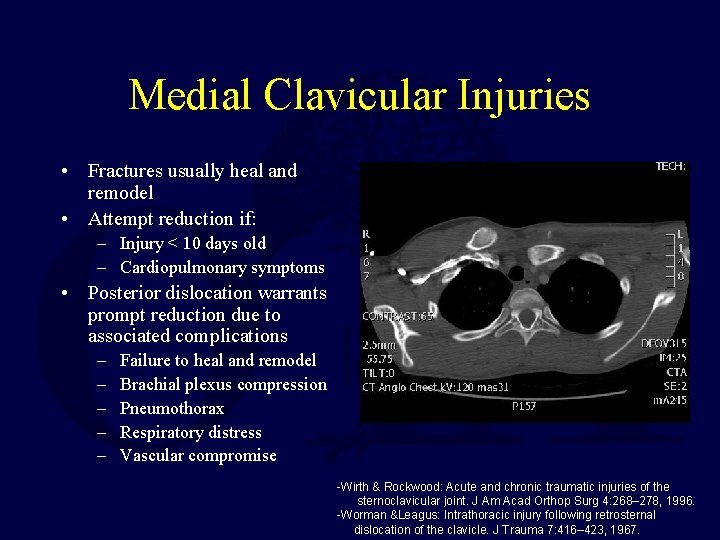 Medial Clavicular Injuries • Fractures usually heal and remodel • Attempt reduction if: –