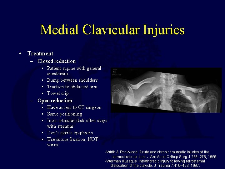 Medial Clavicular Injuries • Treatment – Closed reduction • Patient supine with general anesthesia