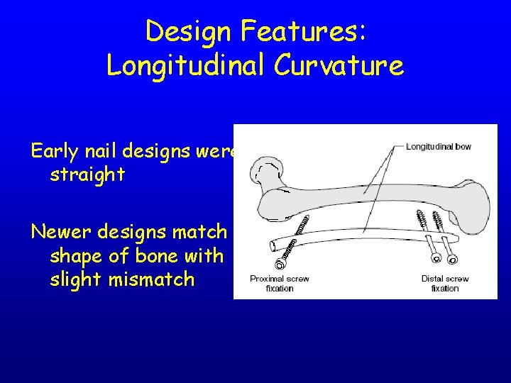 Design Features: Longitudinal Curvature Early nail designs were straight Newer designs match shape of