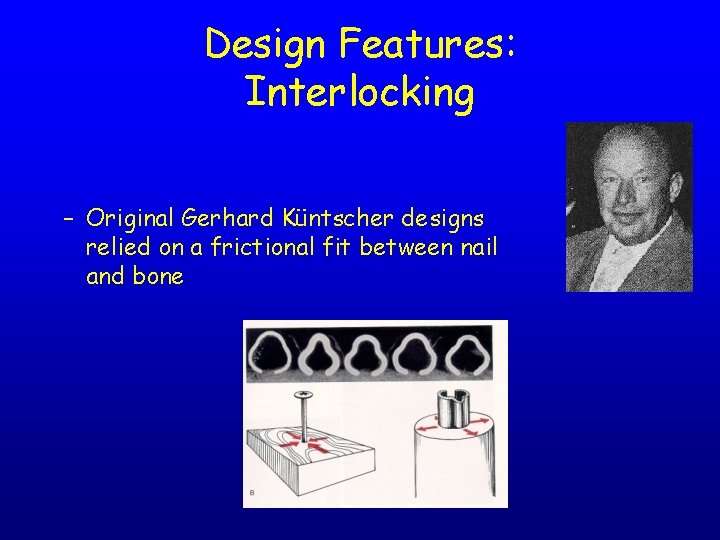 Design Features: Interlocking – Original Gerhard Küntscher designs relied on a frictional fit between