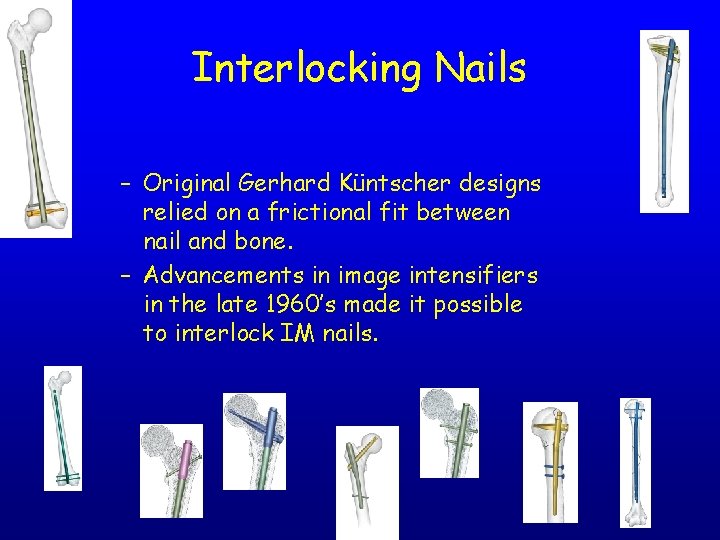 Interlocking Nails – Original Gerhard Küntscher designs relied on a frictional fit between nail