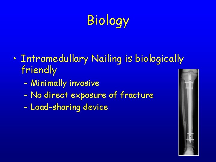 Biology • Intramedullary Nailing is biologically friendly – Minimally invasive – No direct exposure