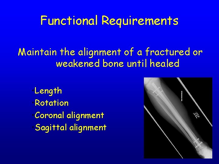 Functional Requirements Maintain the alignment of a fractured or weakened bone until healed •