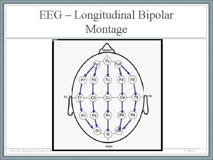 EEG – Longitudinal Bipolar Montage American Epilepsy Society 2015 E Slide 3 