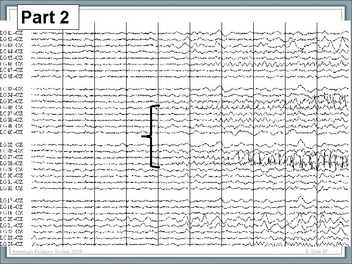 Part 2 American Epilepsy Society 2015 E Slide 57 