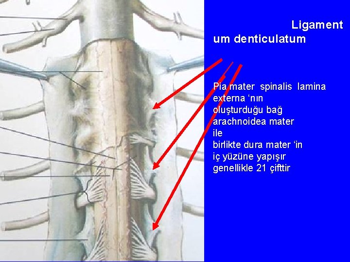 Ligament um denticulatum Pia mater spinalis lamina externa ‘nın oluşturduğu bağ arachnoidea mater ile