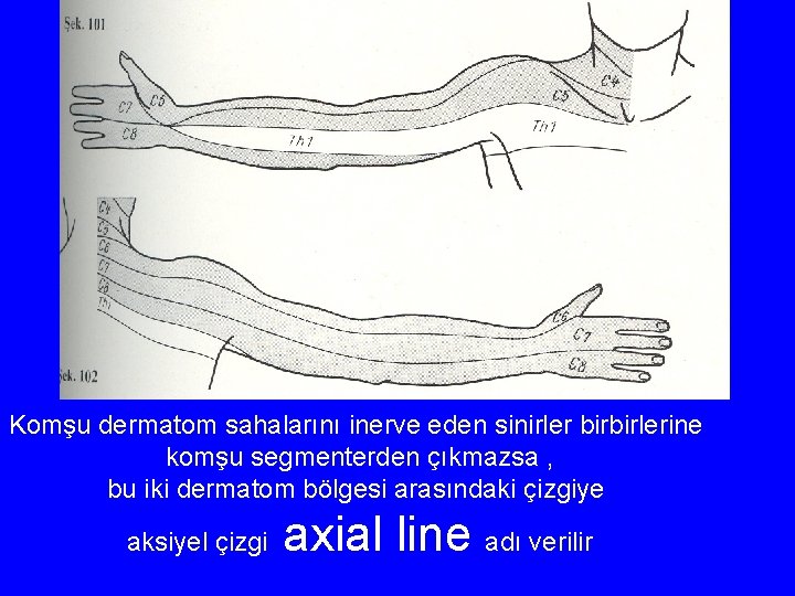 Komşu dermatom sahalarını inerve eden sinirler birbirlerine komşu segmenterden çıkmazsa , bu iki dermatom