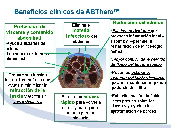 Beneficios clínicos de ABThera. TM Protección de vísceras y contenido abdominal: • Ayuda a