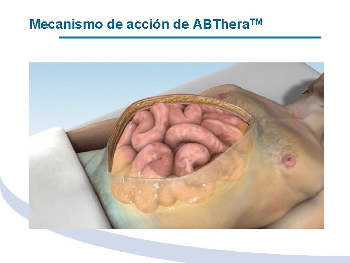 Mecanismo de acción de ABThera. TM 