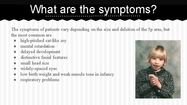 What are the symptoms? The symptoms of patients vary depending on the size and