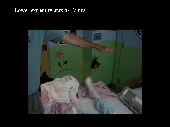 Lower extremity ataxia- Tamra 