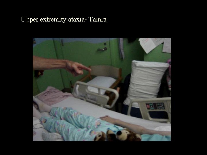 Upper extremity ataxia- Tamra 