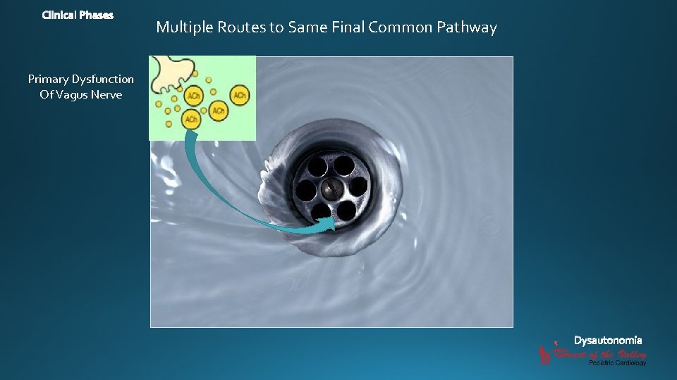 Multiple Routes to Same Final Common Pathway Primary Dysfunction Of Vagus Nerve 