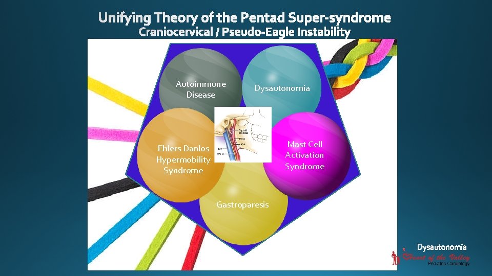 Autoimmune Disease Dysautonomia Mast Cell Activation Syndrome Ehlers Danlos Hypermobility Syndrome Gastroparesis 