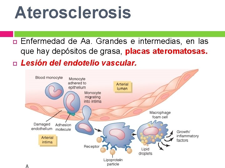 Aterosclerosis Enfermedad de Aa. Grandes e intermedias, en las que hay depósitos de grasa,