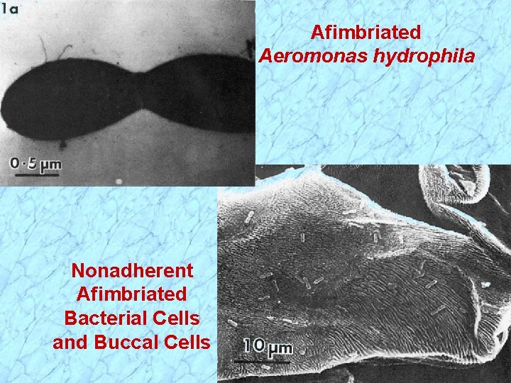 Afimbriated Aeromonas hydrophila Nonadherent Afimbriated Bacterial Cells and Buccal Cells 