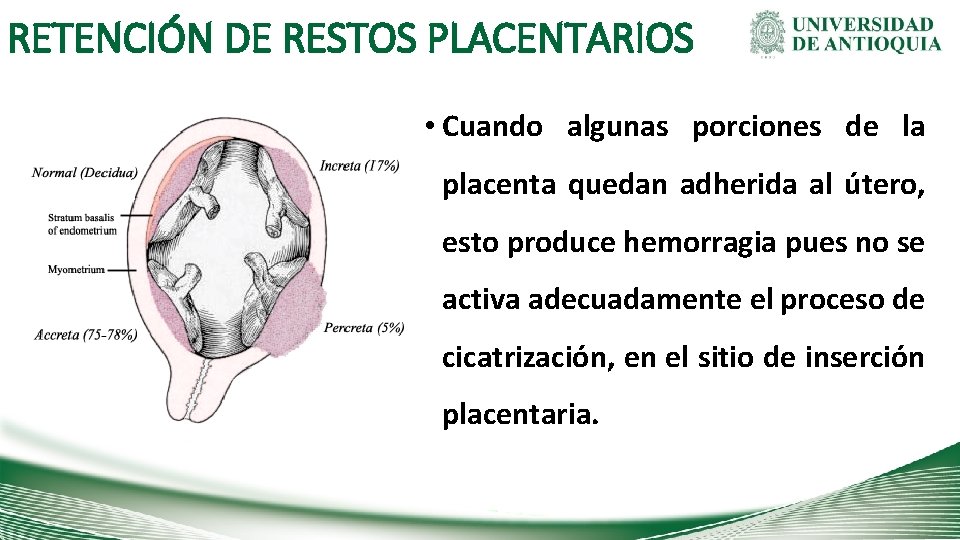 RETENCIÓN DE RESTOS PLACENTARIOS • Cuando algunas porciones de la placenta quedan adherida al