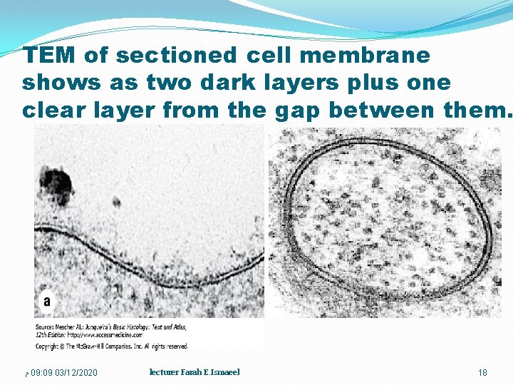 TEM of sectioned cell membrane shows as two dark layers plus one clear layer