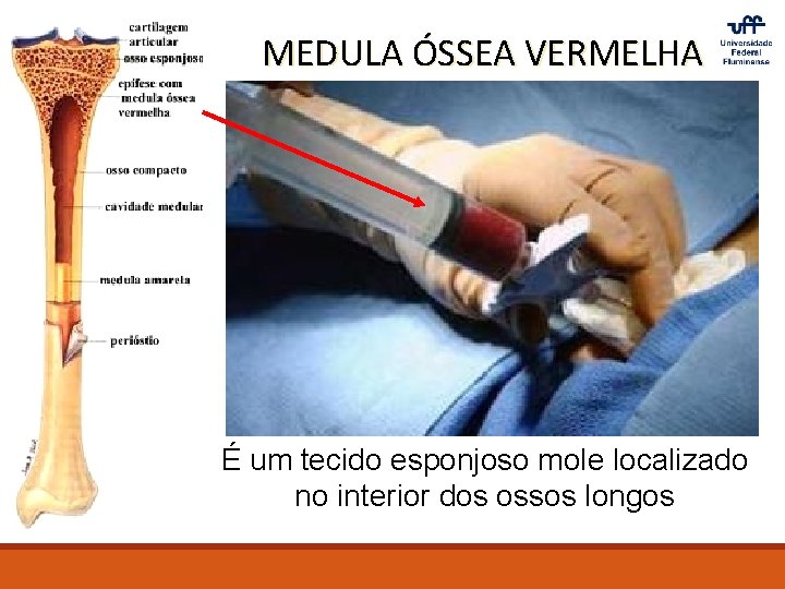 MEDULA ÓSSEA VERMELHA É um tecido esponjoso mole localizado no interior dos ossos longos