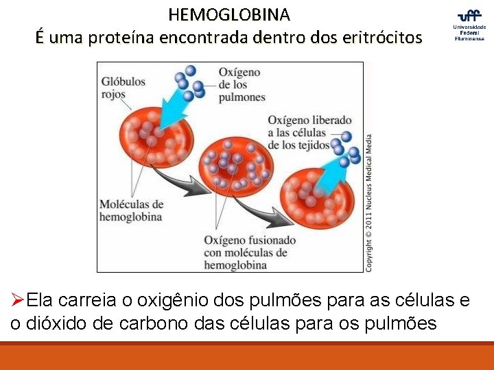 HEMOGLOBINA É uma proteína encontrada dentro dos eritrócitos ØEla carreia o oxigênio dos pulmões