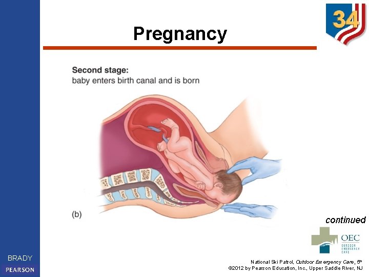 Pregnancy continued BRADY National Ski Patrol, Outdoor Emergency Care, 5 th © 2012 by
