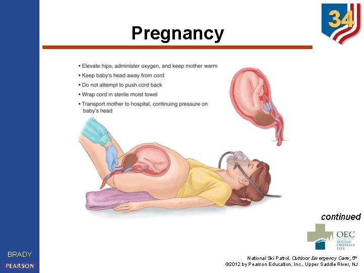 Pregnancy continued BRADY National Ski Patrol, Outdoor Emergency Care, 5 th © 2012 by