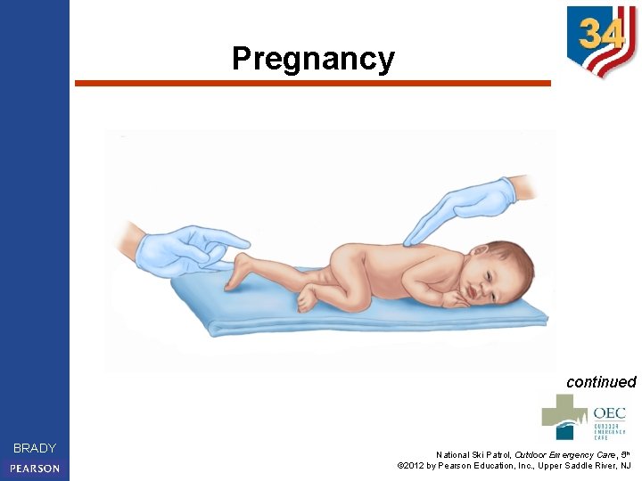 Pregnancy continued BRADY National Ski Patrol, Outdoor Emergency Care, 5 th © 2012 by