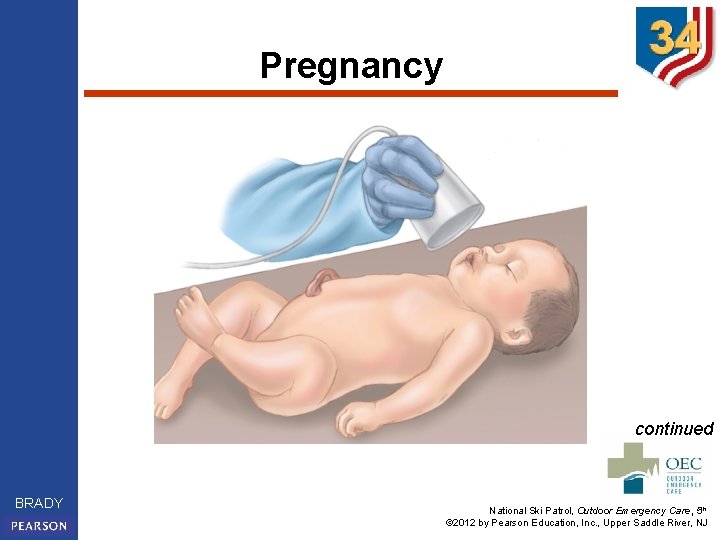 Pregnancy continued BRADY National Ski Patrol, Outdoor Emergency Care, 5 th © 2012 by