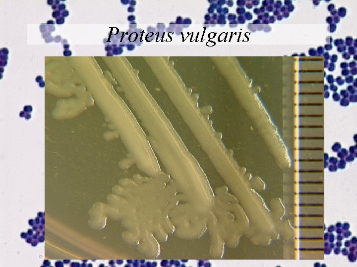 Proteus vulgaris 