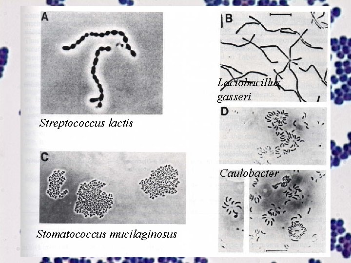 Lactobacillus gasseri Streptococcus lactis Caulobacter Stomatococcus mucilaginosus 