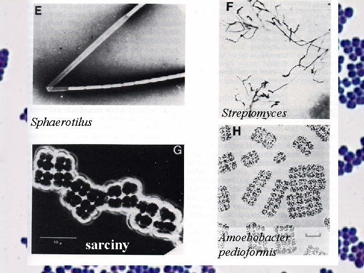 Sphaerotilus Sarcina maxima sarciny Streptomyces Amoebobacter pedioformis 