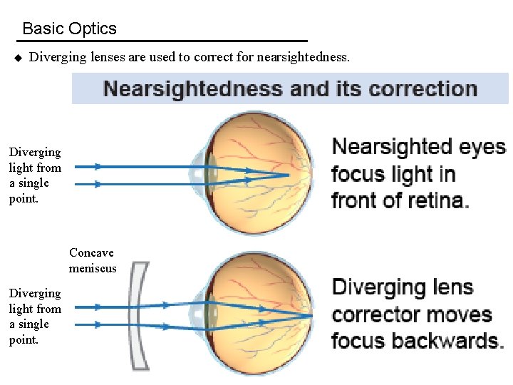 Basic Optics u Diverging lenses are used to correct for nearsightedness. Diverging light from