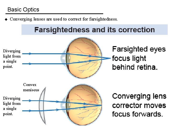 Basic Optics u Converging lenses are used to correct for farsightedness. Diverging light from