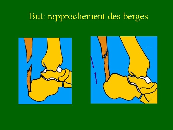 But: rapprochement des berges 