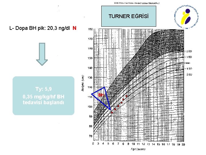 TURNER EĞRİSİ L- Dopa BH pik: 20, 3 ng/dl N Ty: 5, 9 0,