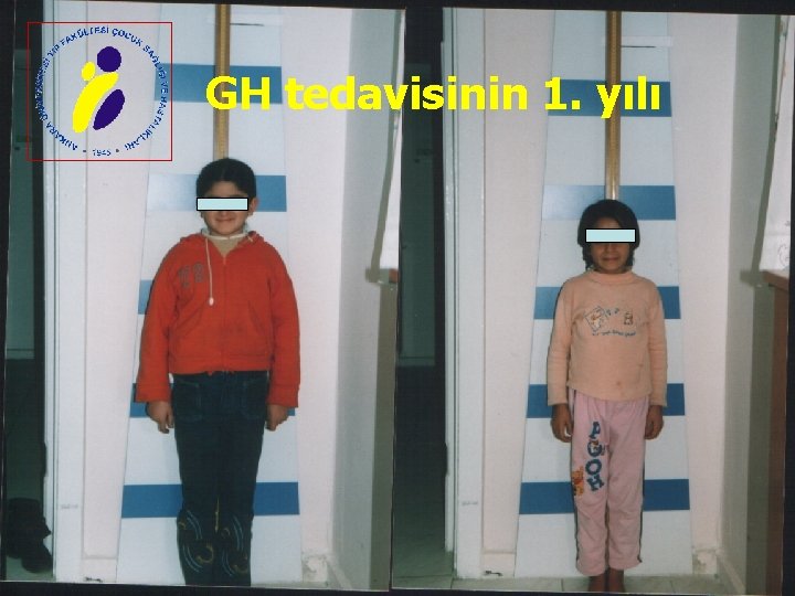 GH tedavisinin 1. yılı 