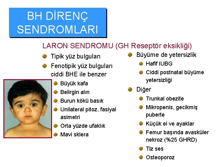 BH DİRENÇ SENDROMLARI LARON SENDROMU (GH Reseptör eksikliği) Tipik yüz bulguları Fenotipik yüz bulguları