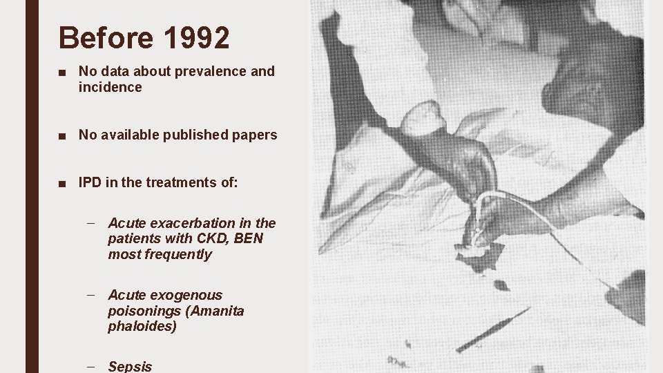 Before 1992 ■ No data about prevalence and incidence ■ No available published papers