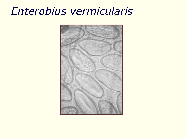 Enterobius vermicularis 