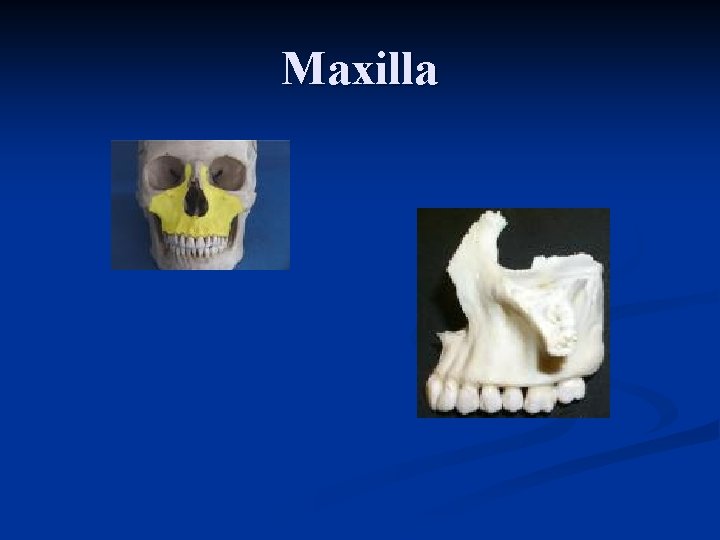 Maxilla 