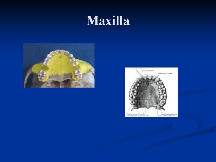 Maxilla 