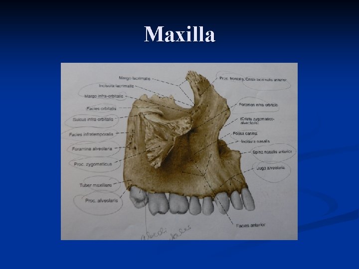 Maxilla 