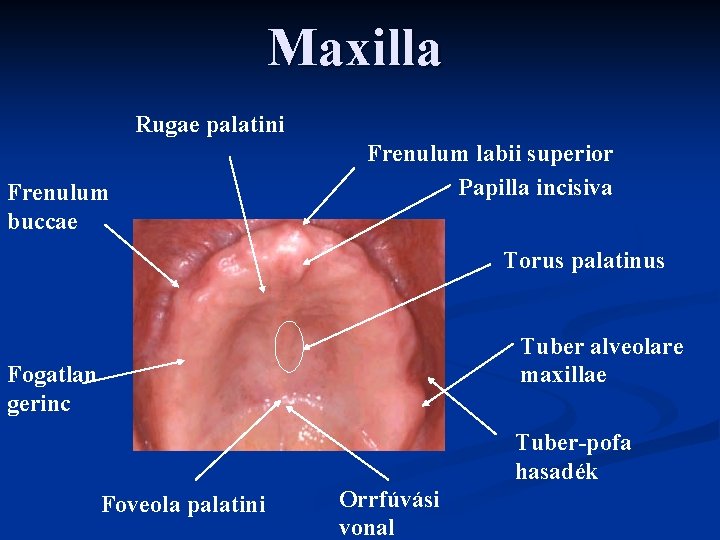 Maxilla Rugae palatini Frenulum buccae Frenulum labii superior Papilla incisiva Torus palatinus Tuber alveolare